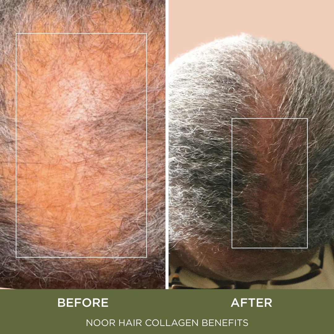 Hydrolyzed Collagen Peptides - Image 5