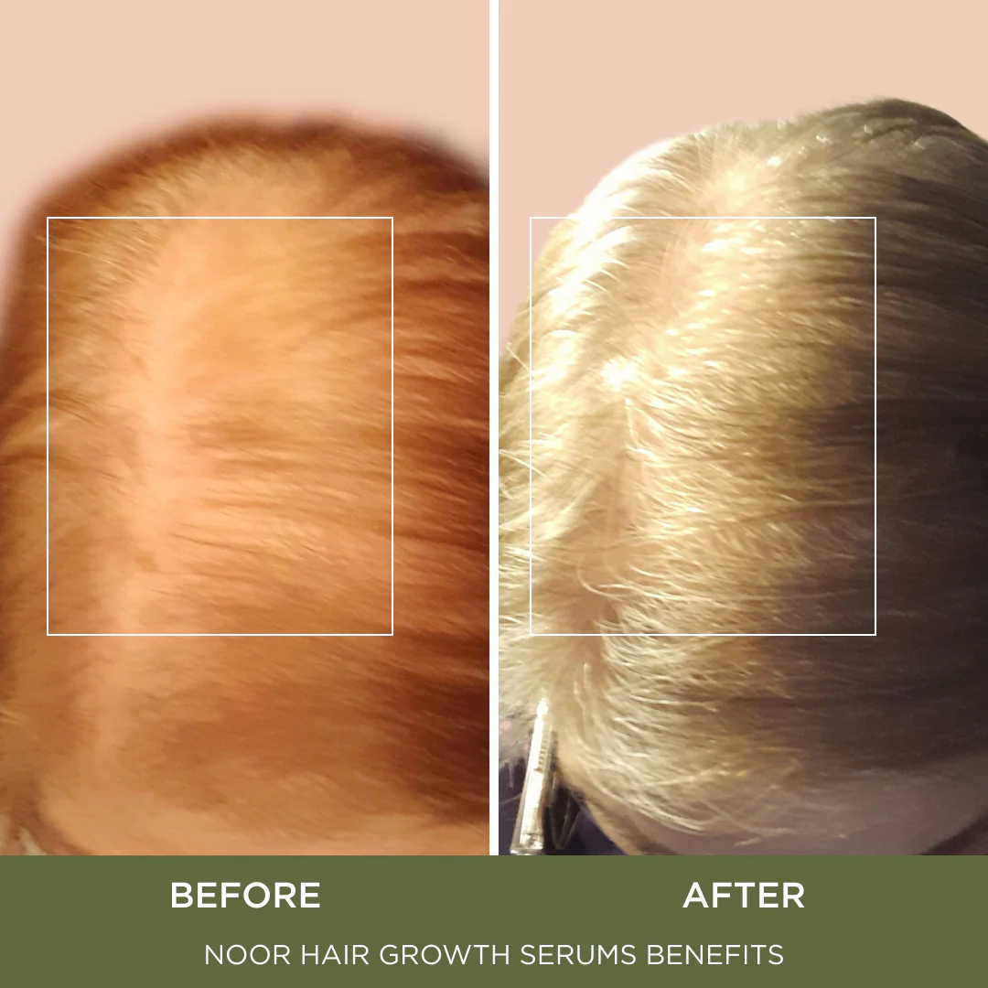 Love Hair Serum - Image 3