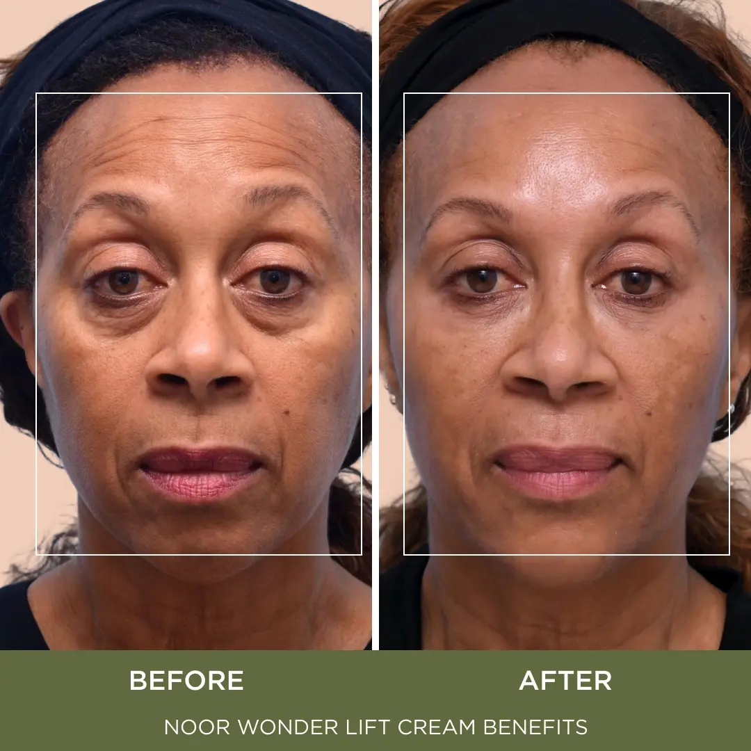 WonderLift Cream - Image 4